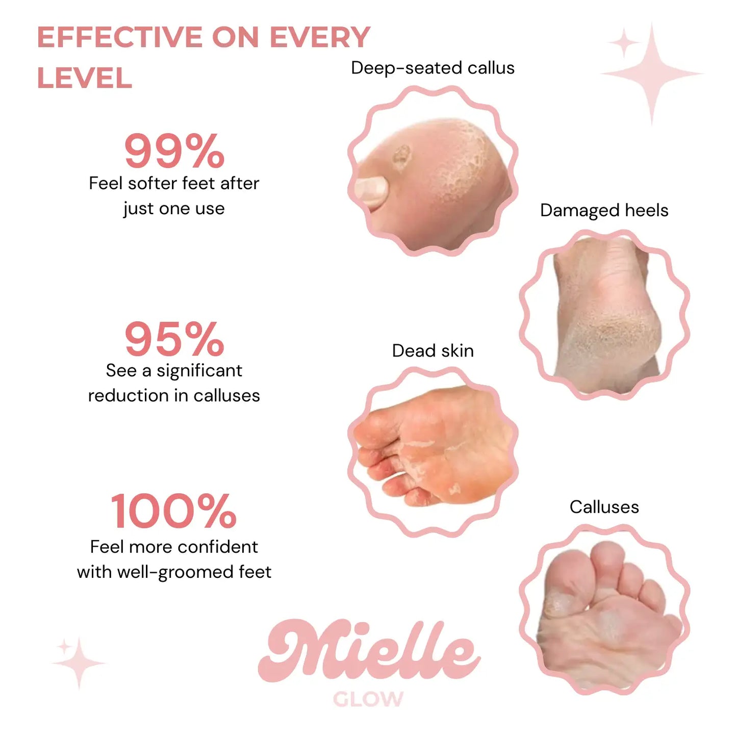 ✨ HoneyGlow™ – Foot Care Kit